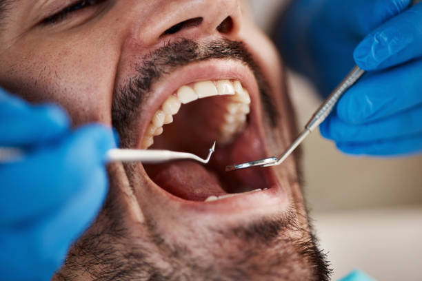 Best Urgent Dental Care in Owosso, MI