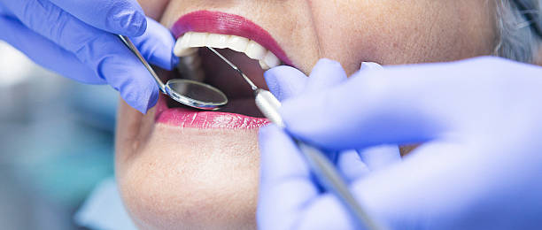 Best Emergency Root Canal Treatment in Owosso, MI